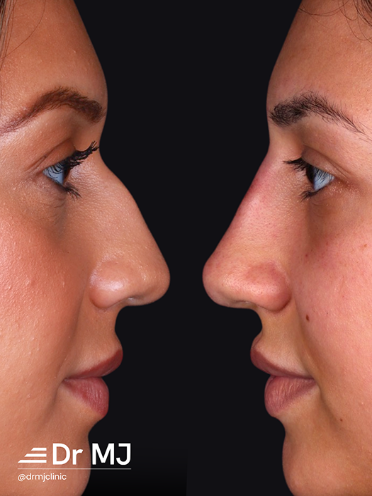Our patients say this procedure has literally changed their lives